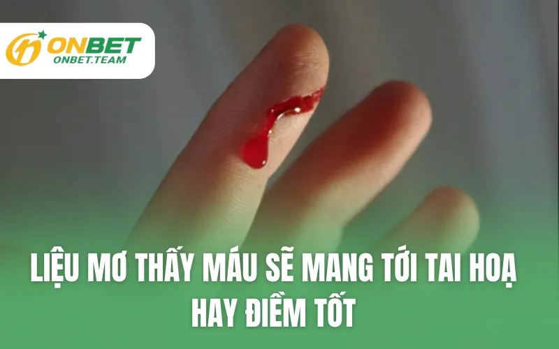 Liệu mơ thấy máu sẽ mang tới tai hoạ hay điềm tốt